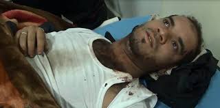ناشط يمني يروي مأساة تعذيبه من قبل الحوثيين