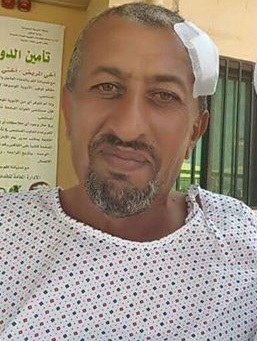 إصابة شقيق القشيبي أثناء قيادته للمعارك ضد مليشيات الحوثي بمنطقة عبس (صورة)