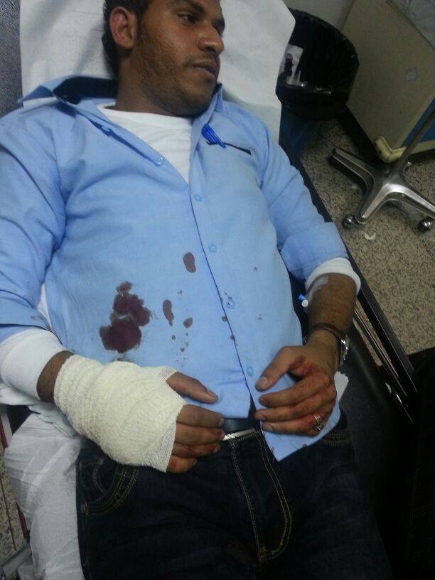 4 جرحى أحدهم بحالة  حرجة في اعتداء لميليشيا الحوثي على مسيرة طلابية بجامعة صنعاء 