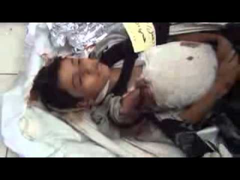 مليشيا الحوثي تقتل الأطفال في تعز
