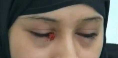 فتاة يمنية تدمع حجاره وصوفاً وتتعرق دماً (فيديو)