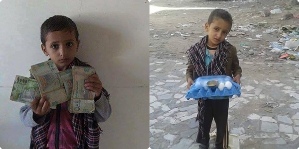 مغترب يمني يشتري من طفل فقير  بيضة بألف دولار ! (صور)