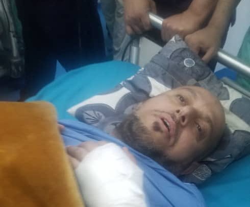 رواية الحوثيين الرسمية لمحاولة اغتيال القيادي المؤتمري أمين جمعان في صنعاء