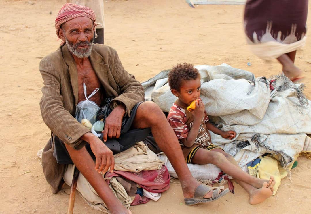 مسؤول حكومي يحذر من كارثة مقبلة على اليمن