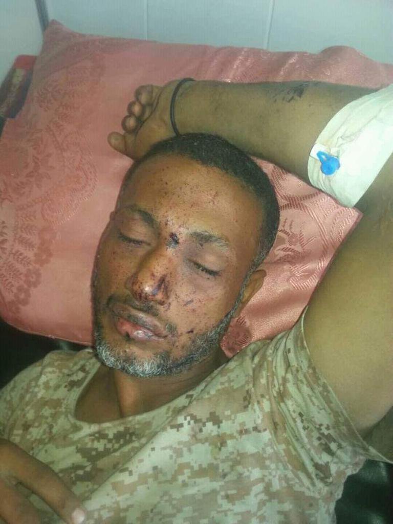 اغتيال قائد عسكري كبير في هجوم بطائرة حوثية مسيرة في الحديدة (صورة)