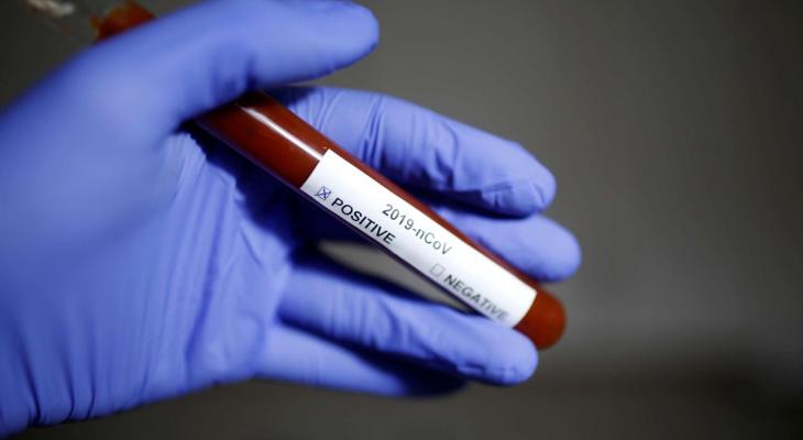تسجيل أول حالة إصابة بفيروس كورونا في صنعاء