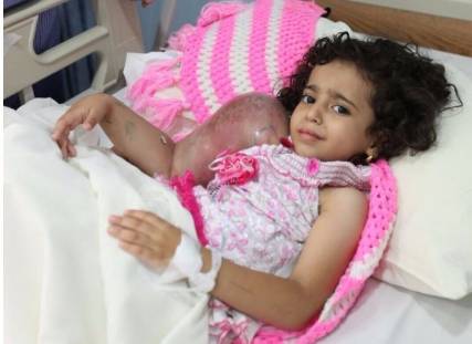 بالصور.. الطفلة اليمنية ريتاج وشقيقتها تصلان مستشفى الحرس الوطني بجدة