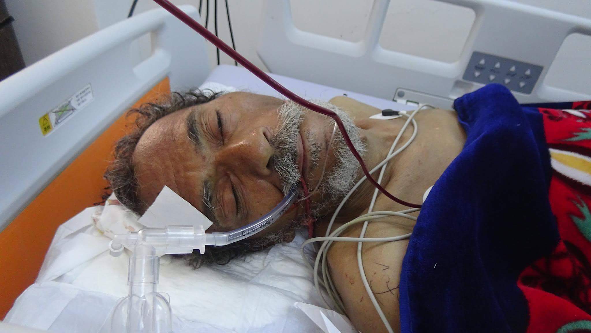 وفاة شيخ مسن متأثراً بإصابته في قصف الحوثيين لمخيم نازحين في وادي حريب نهم شرق صنعاء