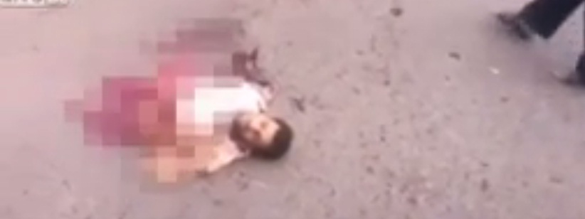 يمني فقد نصف جسده وبقي حياً بعد انفجار عبوة..شاهد الفيديو