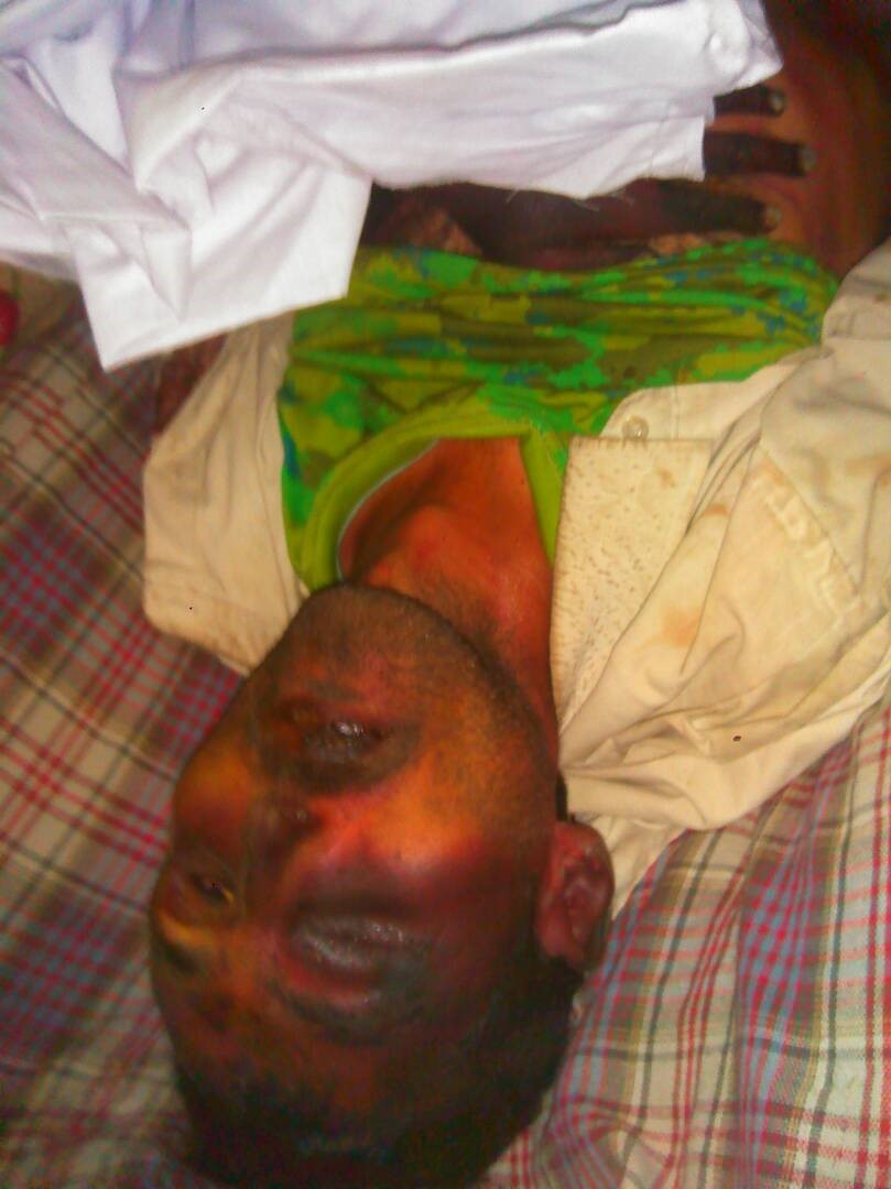 وفاة مختطف تحت التعذيب في سجون المليشيا بمحافظة إب (صور)