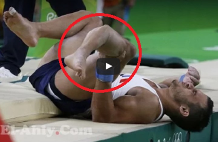 شاهد بالفيديو.. لاعب جمباز فرنسي يتعرض لكسر خطير جدا بأولمبياد ريو