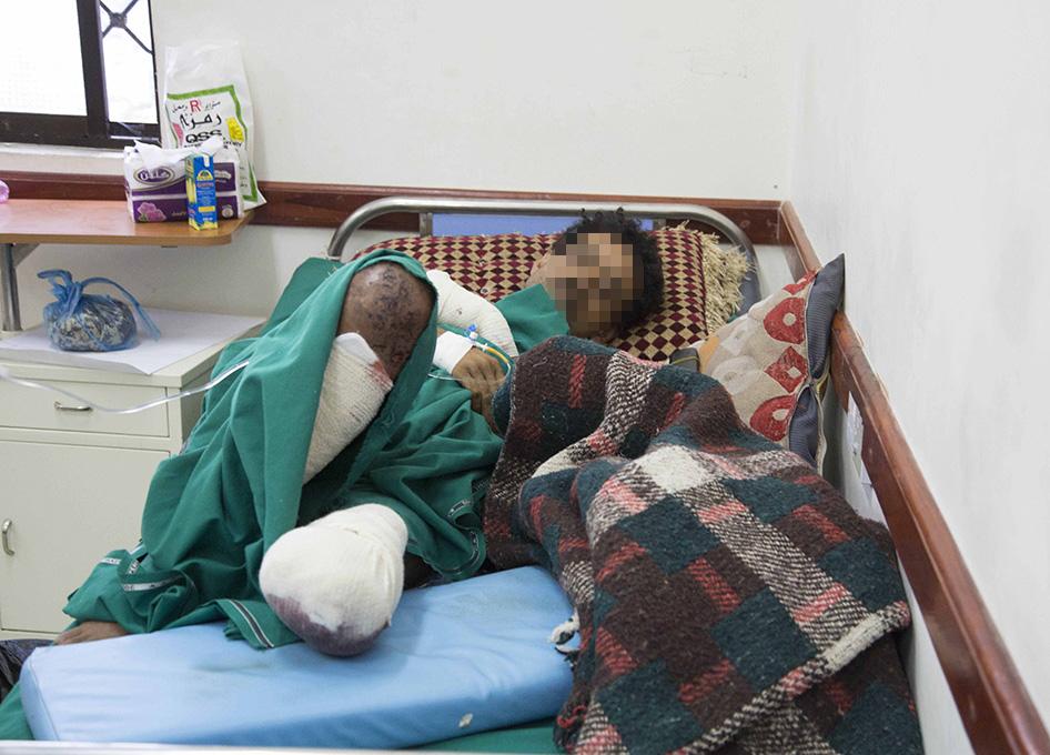 هيومن رايتس تطالب بمعاقبة الحوثيين وقوات صالح لاستخدامهم الألغام ضد المدنيين في تعز