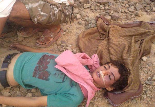 مليشيات الحوثي شنقت طفل في المحويت على خلفية حمله لصورة الملك سلمان !