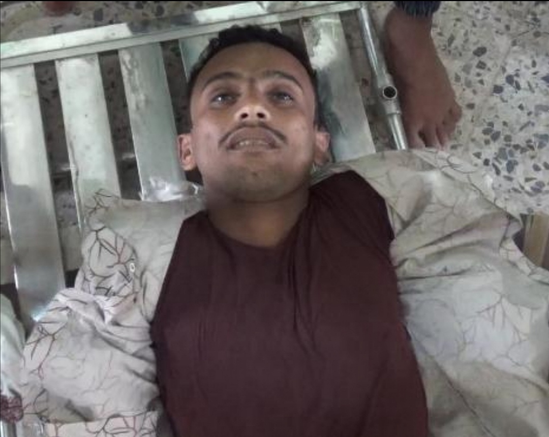 مقتل مواطن في حيس برصاص الحوثيين أثناء أدائه صلاة الجمعة 