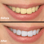 طب وصحة: لماذا يتغير لون الأسنان؟