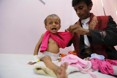 الأمم المتحدة: 7.6مليون يمني على شفا المجاعة وما تم جمعه للآن 16% من حجم المساعدات المطلوبة