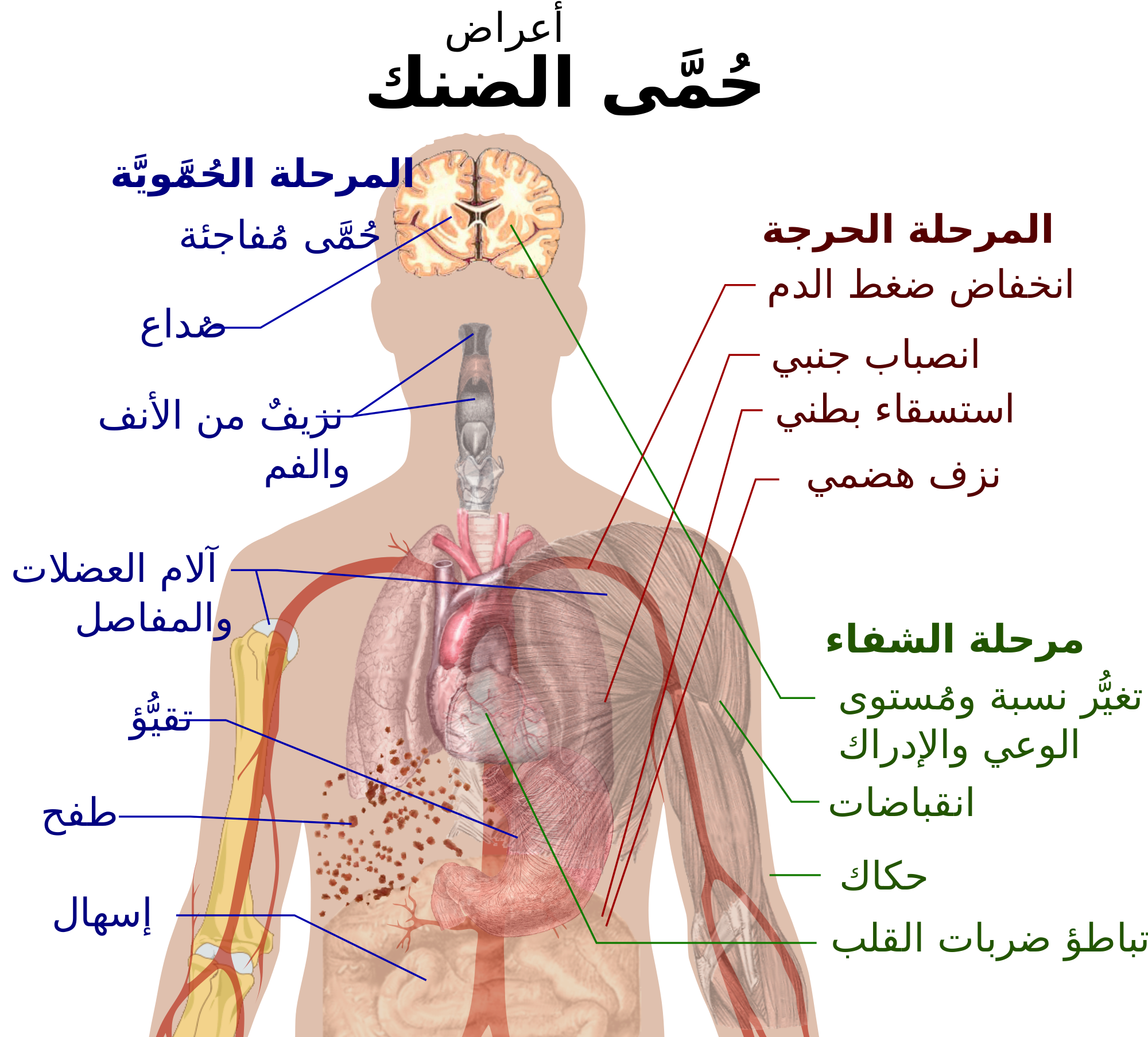 حمى الضنك يصل محافظة إب وتسجيل أول حالة وفاة بالوباء