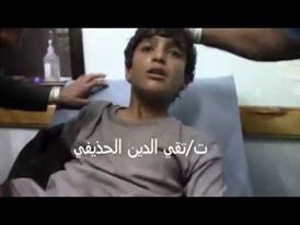 بالفيديو: قوات الجيش والمقاومة بتعز تأسر طفل جريح غرر به الحوثيون في المعارك وتنقله للمستشفى