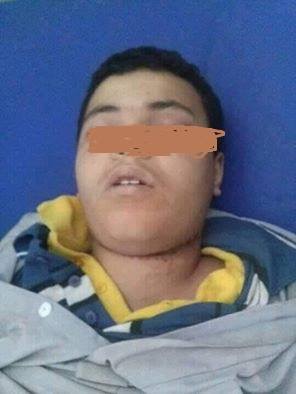 طفل يتيم في اب يقتل نفسه شنقاً بعد وفاة كفيله الشيخ الأشول