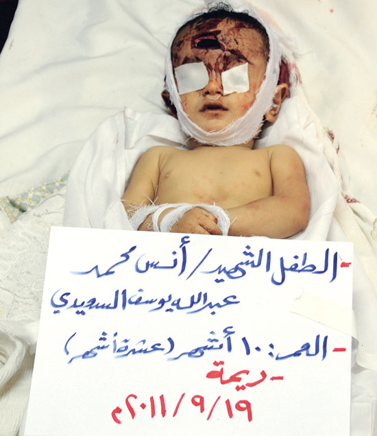 الطفل أنس محمد السعيدي الذي استشهد وهو في حضن والده