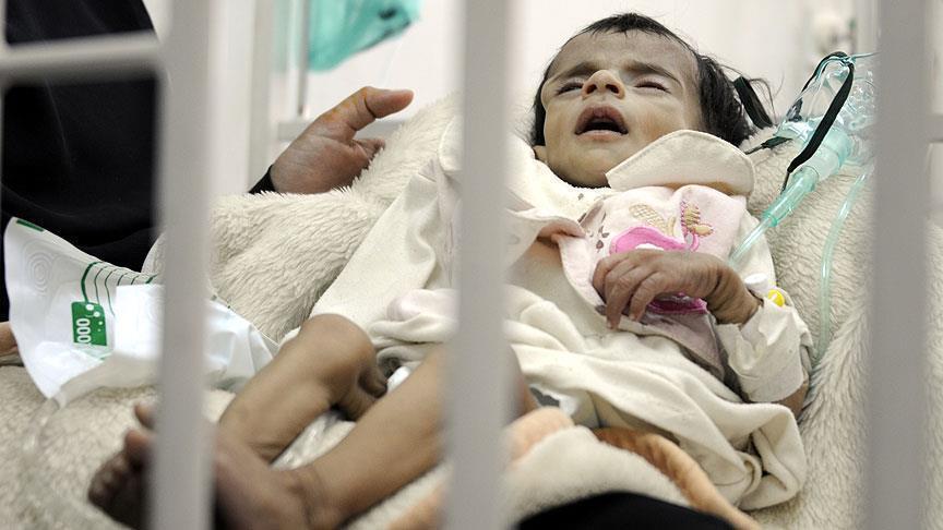 صورة لطفل مصاب بااعراض الكوليرا في اليمن - ارشيفية