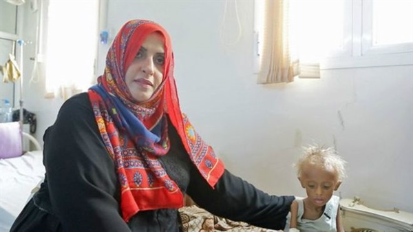امرأة واحدة تحارب المجاعة في اليمن