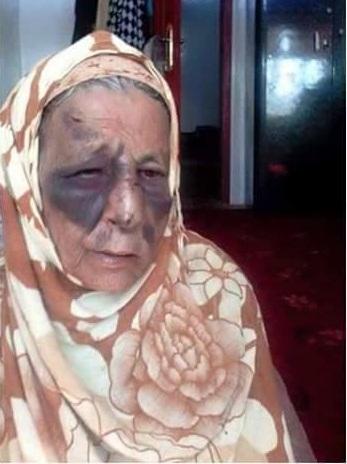 شاهد صورة مؤلمة جداً في اليمن.. رجل يُحرض زوجته مع اخواتها لتضرب أمه