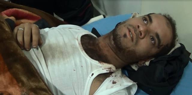 العثور على ناشط تعرض للتعذيب بعد إختطافه من مسيرة مناهضة للحوثيين
